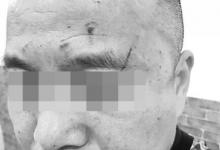 女医生称因不会宰病人被领导打 院长：她先动手