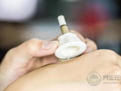 艾艾贴艾灸器：知名养生节目都在讲它，连《向往的生活》里都有它
