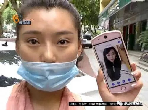 三女子整容均出现不同程度歪斜 义乌阳光美容医院：本身就有问题