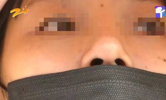 杭州甄美整形医院把人鼻子整歪了？医院：自己长歪了