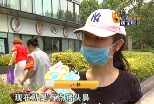 杭州画蝶医疗美容医院做整形 鼻子没做好做成了猪头鼻