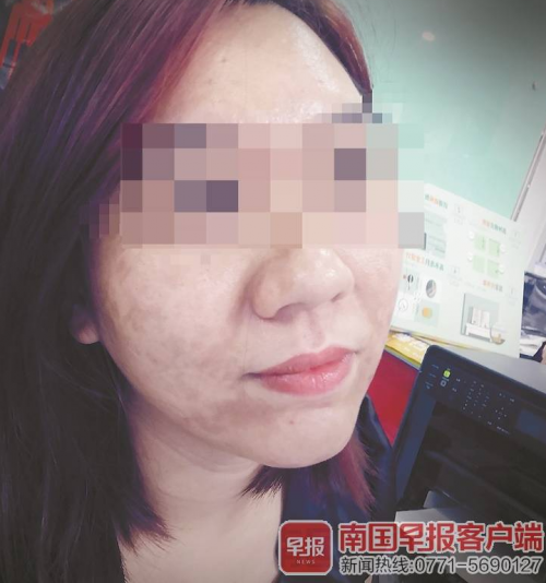 南宁华美医院打“水光针”后悲剧了 医生还未取得执业医生资格证