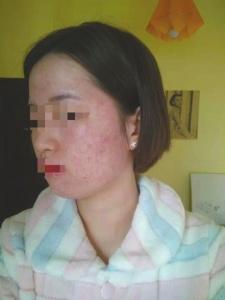 成都蕾特恩专业祛痘怎么样？推销陷阱多 81名消费者集体控诉蕾特恩