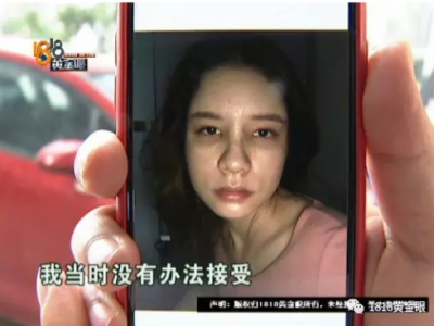女子花4万多在宁波首美整形美容医院做鼻子 术后鼻子却像被人打过