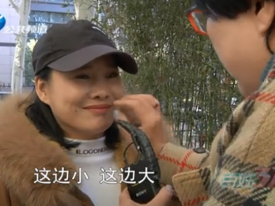 整形有风险！女子在郑州东方整形医院手术后脸一边大一边小