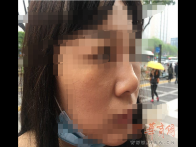 西安艺星美容整形医院：医美没有统一标准 鼻子凹凸不平属于正常