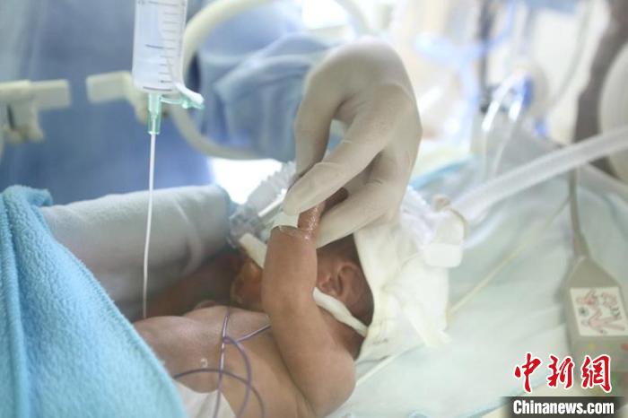 报告称:中国极早产儿、极低出生体重早产儿存活率明显提高-易网<a href=http://www.bryss.cn/ target=_blank class=infotextkey>健康养生</a>网 报告称:中国极早产儿、极低出生体重早产儿存活率明显提高