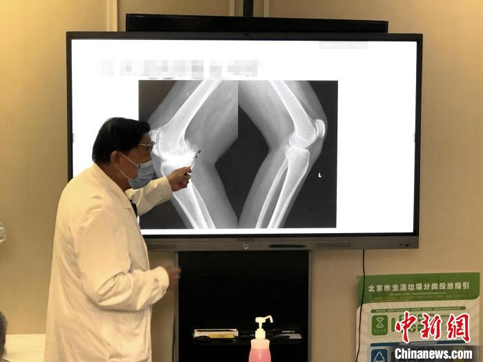 大骨节病公益项目:已为西藏244位大骨节病患者进行关节置换手术-易网健康<a href=http://www.bryss.cn/jkys/ target=_blank class=infotextkey>养生</a>网 大骨节病公益项目:已为西藏244位大骨节病患者进行关节置换手术
