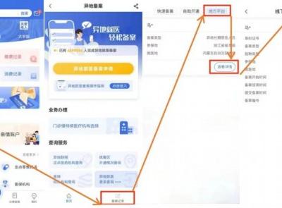 关于异地就医直接结算，这份小贴士请查收