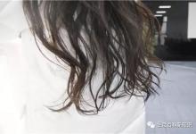 脱发严重怎么办?怎样做,才可以缓解脱发?