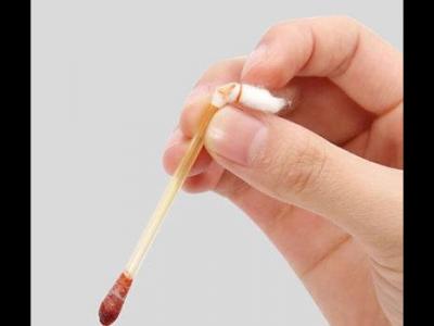 当身体出现伤口可以用碘伏消毒吗