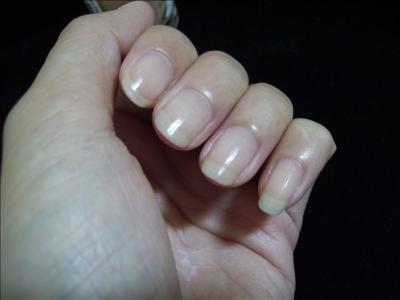 指甲的?；し椒ㄖ讣资帕芽脑?  style=