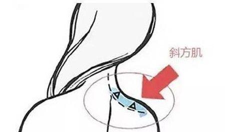 斜方肌可以通过按摩的方式消除吗