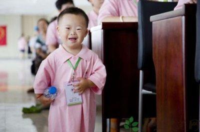 小孩患有唐氏综合症会有哪些明显症状