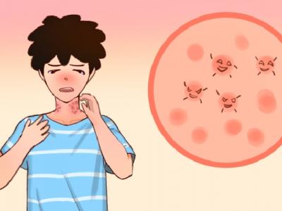 三伏天怎么去除体内湿气 三伏天养生五大要点