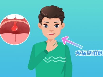 扁桃体炎是什么症状