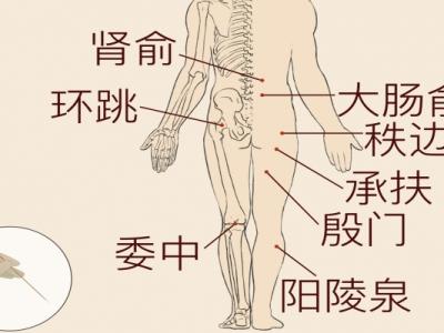 哪些中药治疗腰间盘突出