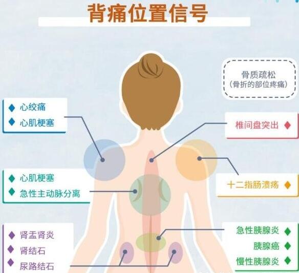 女性后背疼警惕四种病，腰部周围痛小心妇科病(疼痛位置图解)