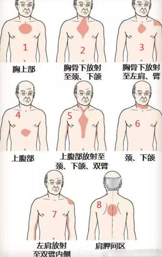 女性后背疼警惕四种病，腰部周围痛小心妇科病(疼痛位置图解)