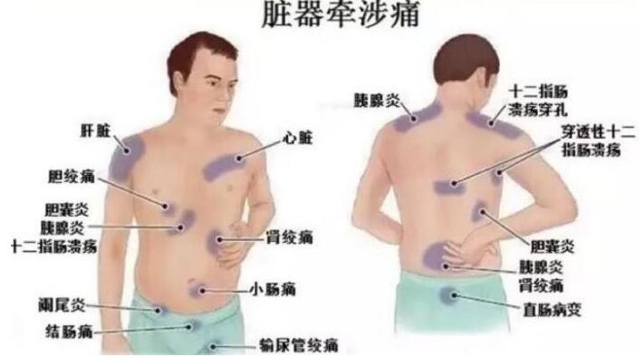 女性后背疼警惕四种病，腰部周围痛小心妇科病(疼痛位置图解)