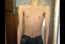 80斤瘦弱男生锻炼变男神的增肌故事