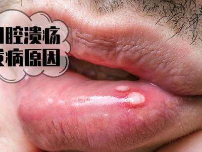 减肥妙招 最棒的乳制品零食是酸奶