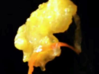锅包鱼片的做法-酸甜味炸菜谱