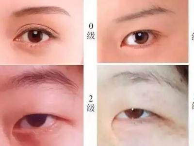 双眼皮贴是在眼影之前还是之后？眼妆注意事项有哪些？