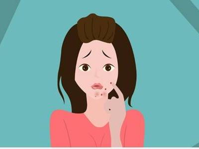 女生下巴长痘的原因，教你六个诀窍简单祛痘