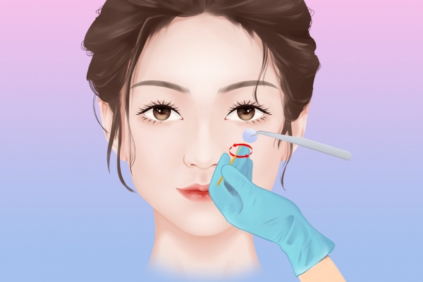 美白针打在哪里