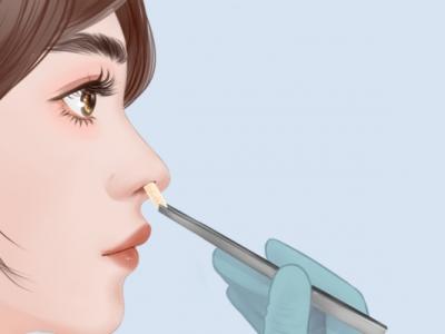 隆鼻手术的风险大吗