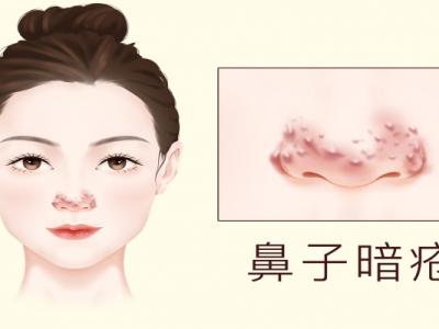 脸色暗沉发黑怎么才能变白