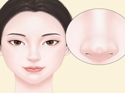 隆鼻可以只隆鼻梁不隆鼻尖吗