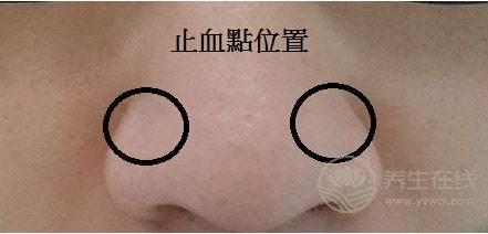 秋季流鼻血更加频繁，怎样才能有效止血呢?