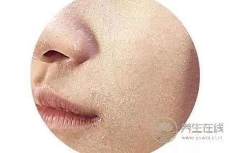 秋季皮肤为什么会过敏?秋季皮肤过敏有什么症状?