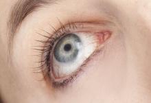 倒春寒 需谨防三种眼病