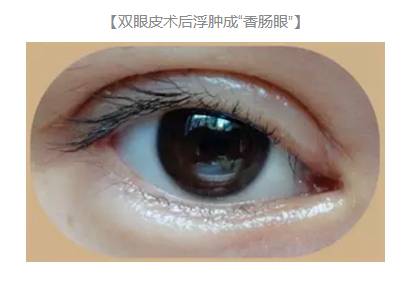 双眼皮术后出现上睑下垂怎么办？