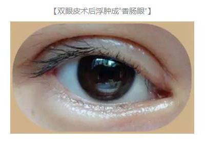双眼皮术后出现上睑下垂怎么办？