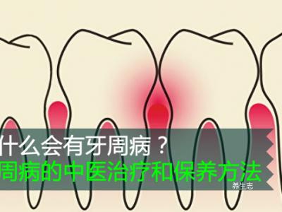 为什么会有牙周?。垦乐懿〉闹幸街瘟坪捅Ｑ椒?  style=