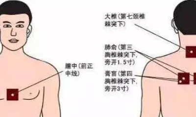 三伏贴贴什么位置图