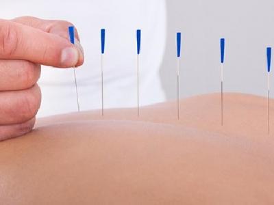 中医针灸如何治疗乳腺增生 关于针灸乳腺增生的治疗方法介绍
