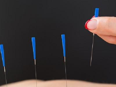 中医针灸治疗痛经效果好吗 中医针灸治疗痛经需了解三方面